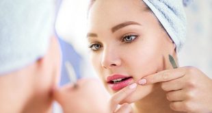 7 mauvaises habitudes qui peuvent accentuer votre acné