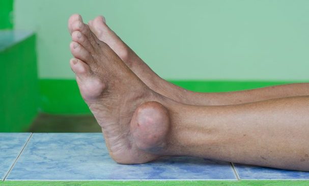 Foot Doctor